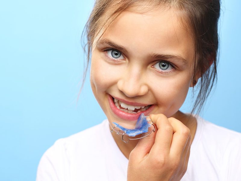 aparelho-ortodontico-05