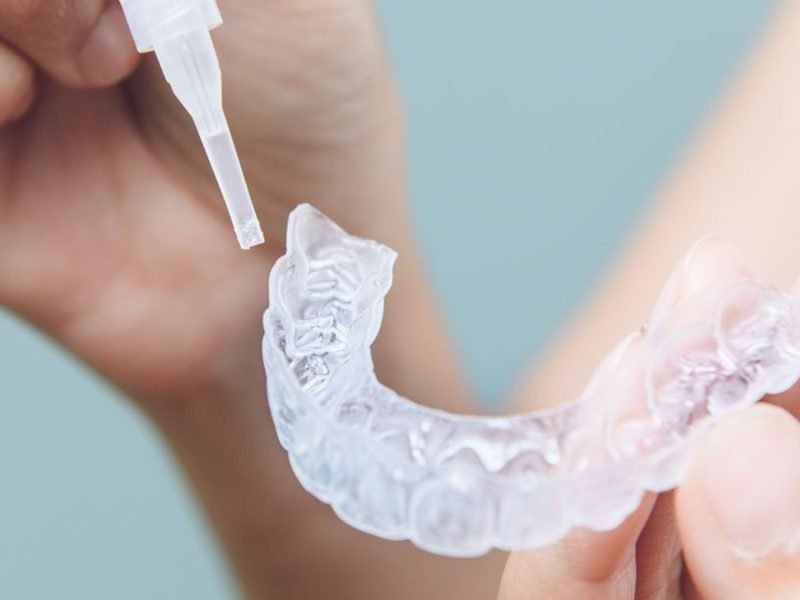 clareamento-dental-01