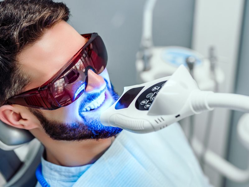 clareamento-dental-03