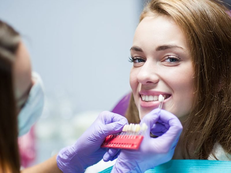 clareamento-dental-05