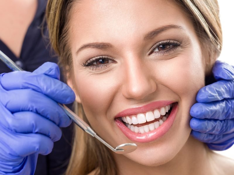 clareamento-dental-06