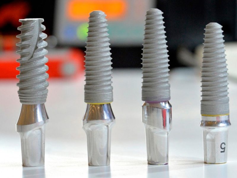 implante-dentário-04