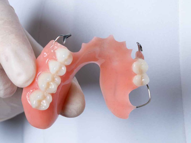 prótese-dentaria-05