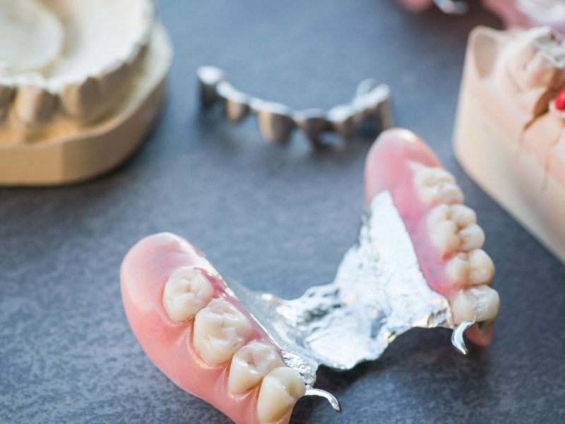 prótese-dentaria-06