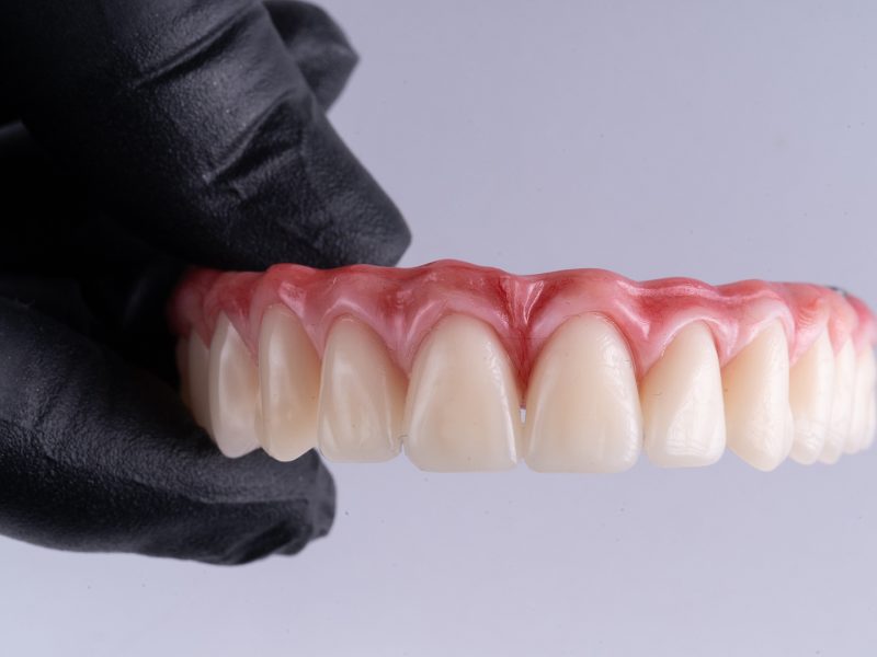 protese-protocolo-01