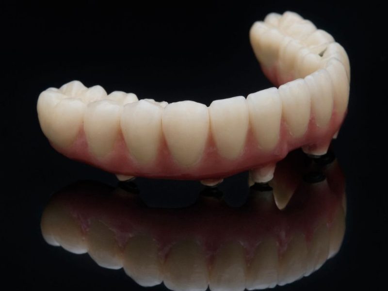 protese-protocolo-05