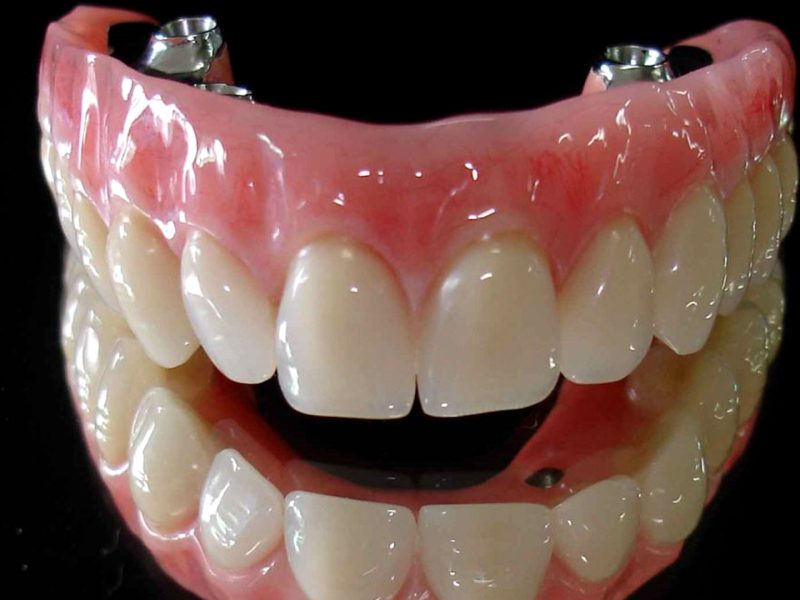 protese-protocolo-06